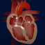 Thumbnail What is Atrial Fibrillation?